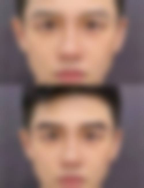 韩国Newstar Clinic整形外科特色项目及技术优势