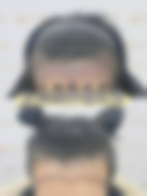 杨海平医师的专属个性化诊疗特色