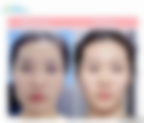 昆明菲岫皮肤医疗美容诊所特色项目及技术优势