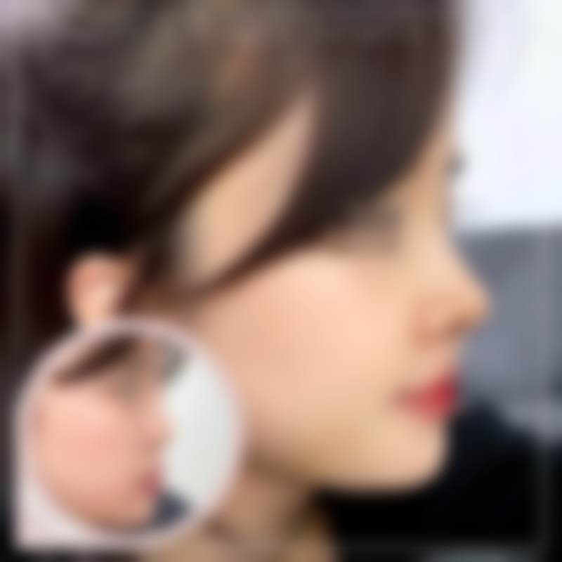 韩国优雅人整形外科医院怎么样来院路线