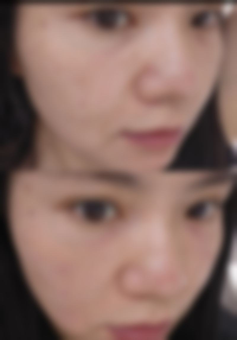 湖南长沙你美医疗美容医院求美者反馈