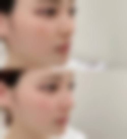 佟以萍提供专属面诊询问,解答您的所有医美疑问