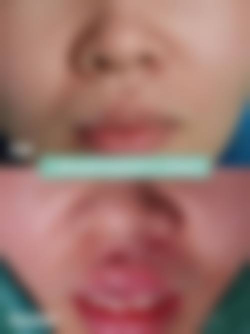 焦作民鑫医疗美容特色项目及技术优势