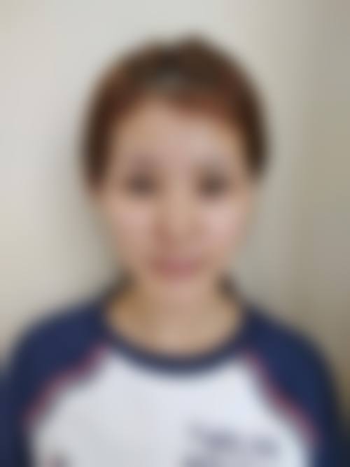 山西晋中美丽韩医疗整形美容门诊部求美者反馈