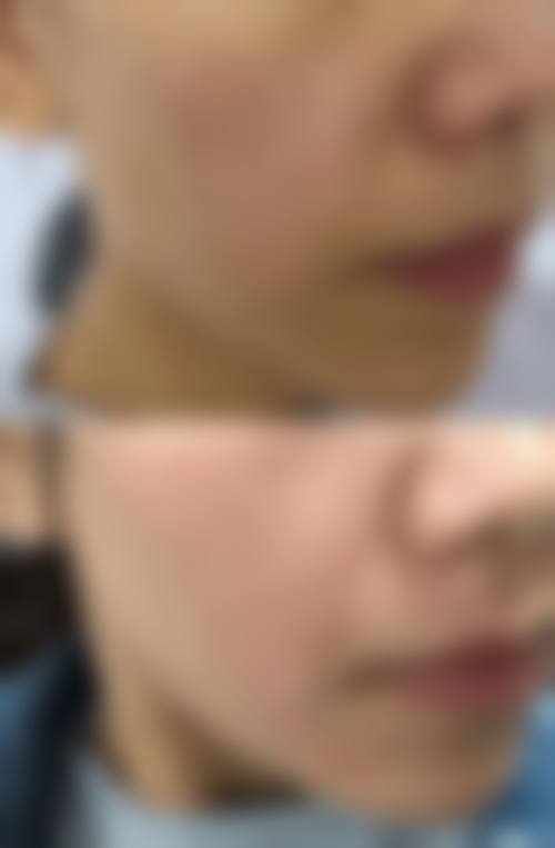 王莹雪医生可开展的特色与常规医美项目