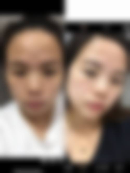 安徽省安庆岳西县中医院求美者反馈