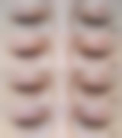 宿州阳光医疗美容医院求美者反馈