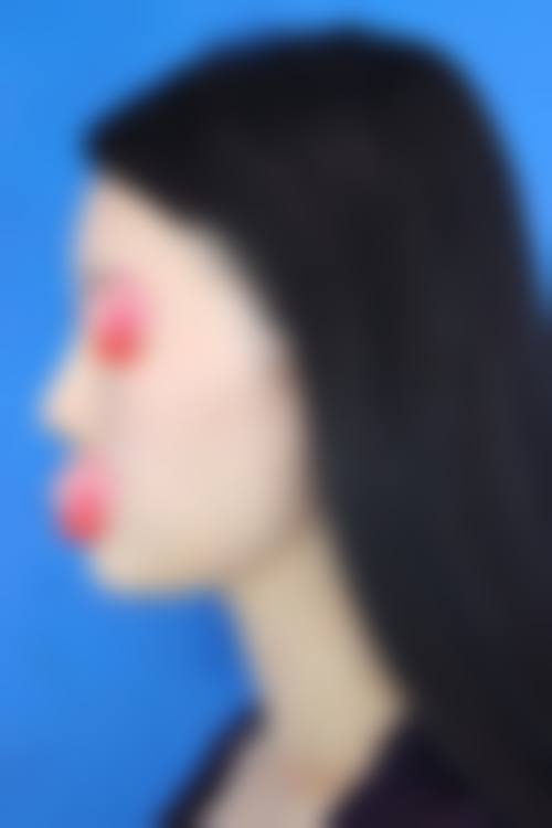 韩国Yonsei C&ENT整形外科特色项目及技术优势