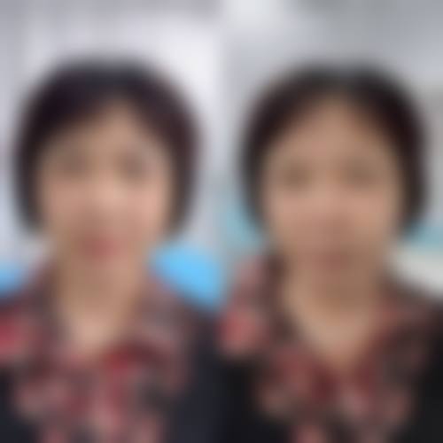 广西科技大学第一附属医院(医疗美容整形外科)求美者反馈