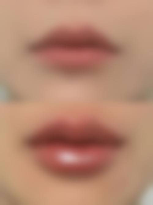 舒辟峰医生的特色技术：自然与安心兼顾的塑美方案