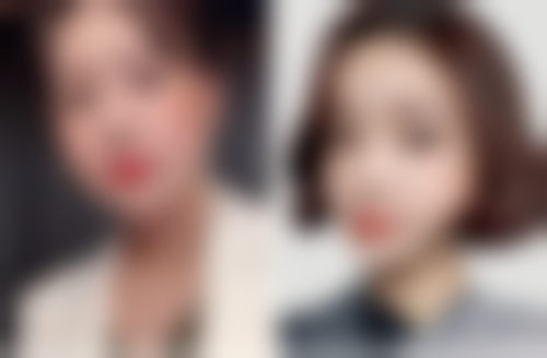 韩国SNOW整形外科医院来院路线