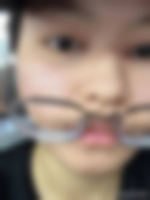 韩国SNOW整形外科医院求美者反馈