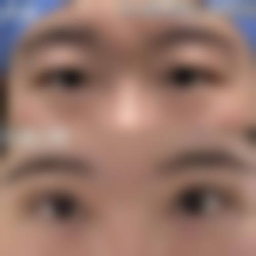 杭州大隐医疗美容诊所求美者反馈