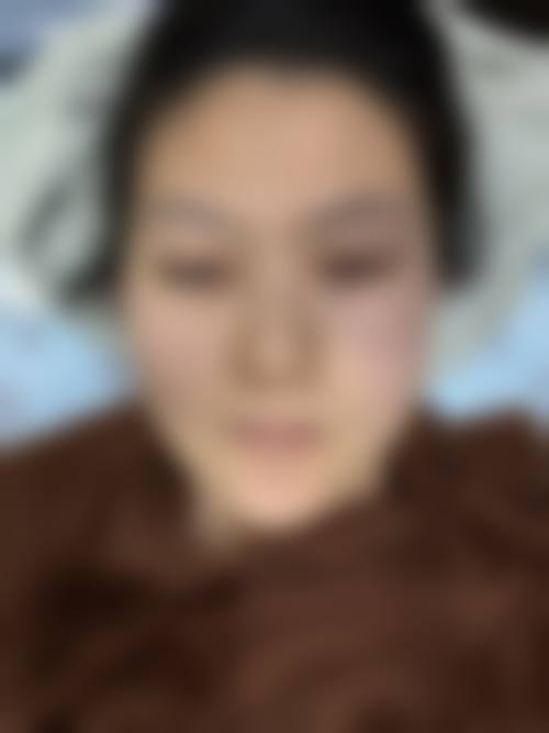 南阳维多利亚美容诊所价格收费