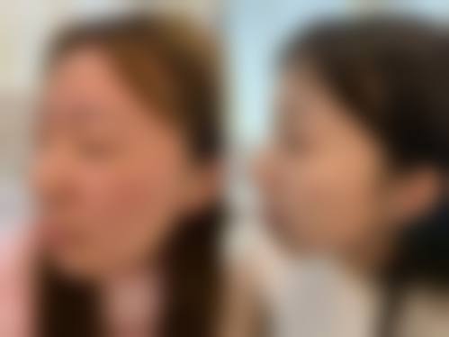 合肥壹美尚美容医院求美者反馈