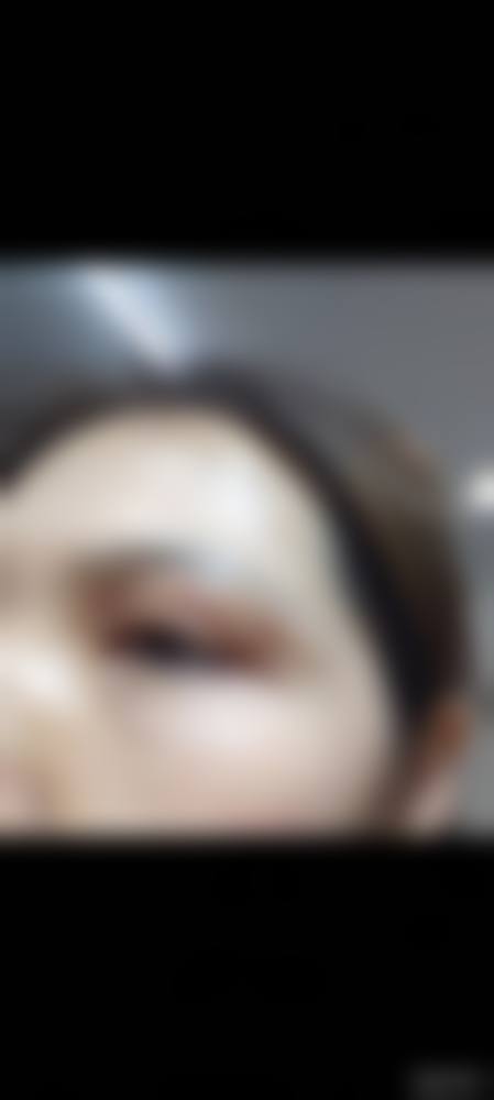 北京长虹医院整形科求美者反馈