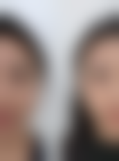 温州华悦（皇佳）医疗美容门诊求美者反馈