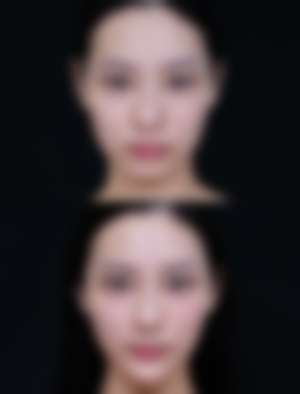 杭州大隐医疗美容诊所特色项目及技术优势