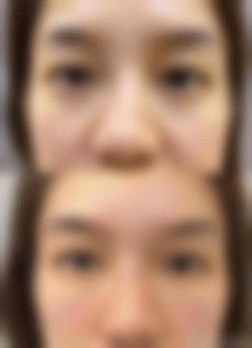 吕梁丽都整形医院价格收费