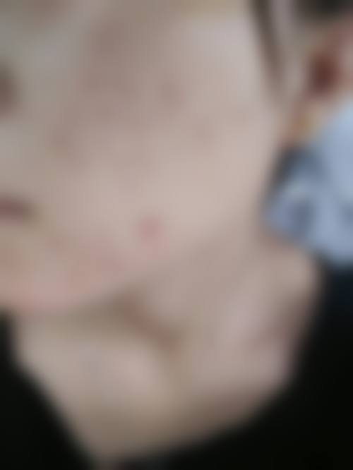 廖应杰的就诊询问与预约指引