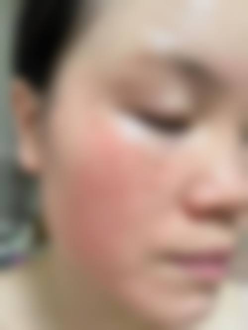 便捷预约与到院指南，轻松邂逅专属美丽