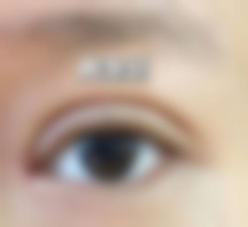 李俊浩院长的精细化诊疗特色