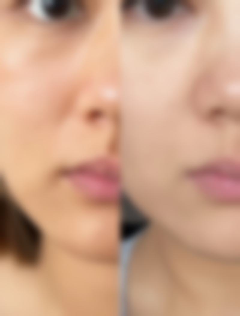 福州星龄整形求美者反馈