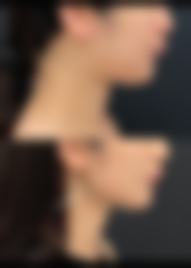 贵阳枫林晴医疗美容求美者反馈