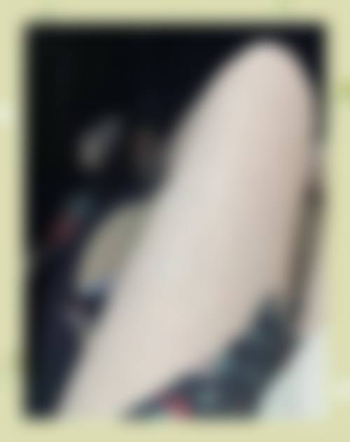 郑支恩医生精细化个性化的诊疗特色