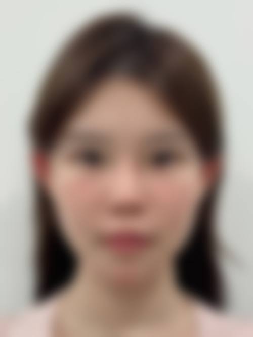 韩国清潭JUAN皮肤科医院求美者反馈