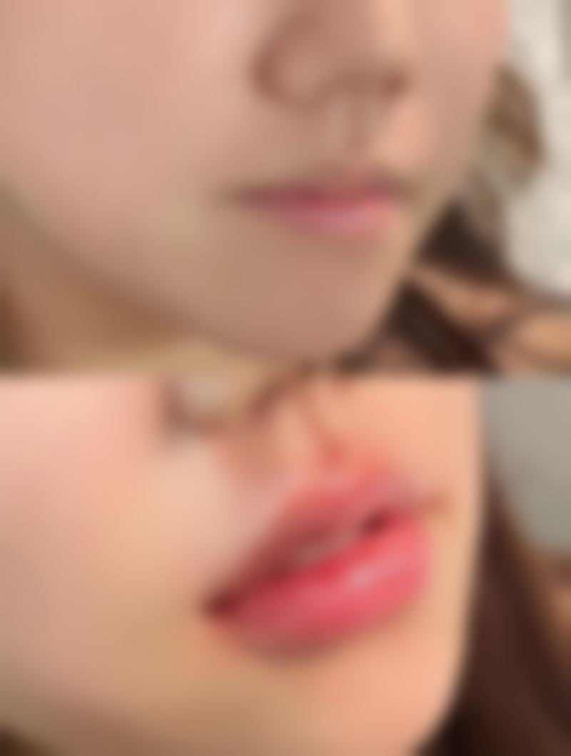 深圳黄崇熙整形医院求美者反馈