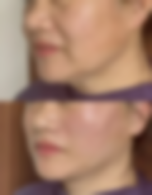 北京青丝恋植发医院来院路线