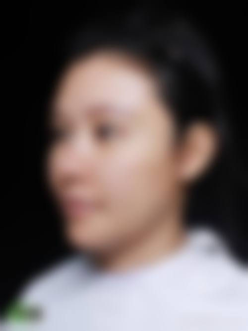 韩国VIP整形外科特色项目及技术优势