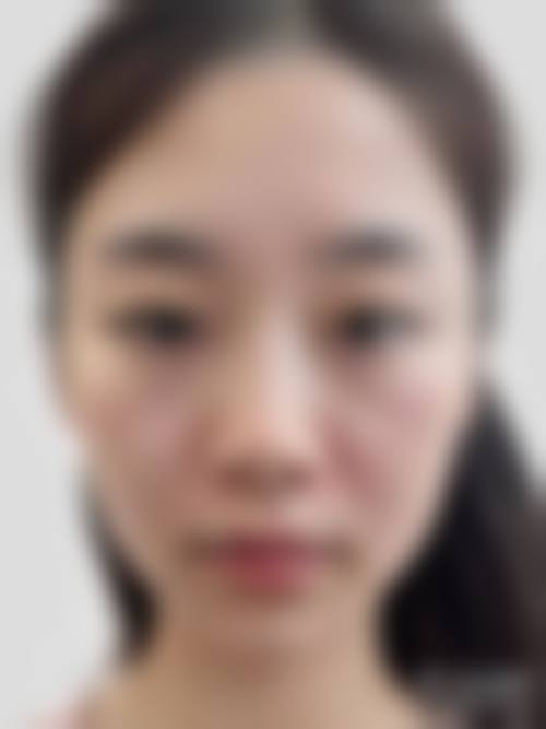 海南比华利特莱美医疗美容医院价格收费