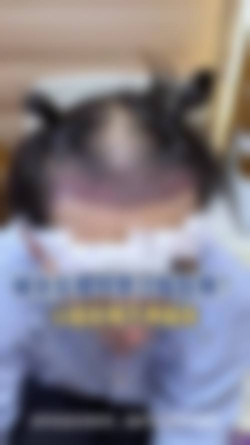 上海411医院植发科预约指南