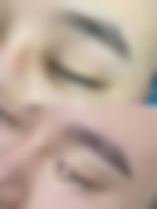 上海411医院植发科特色项目及技术优势