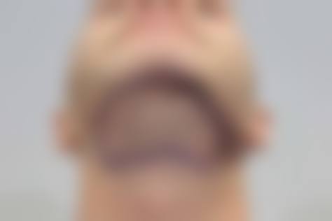 上海411医院植发科医生团队实力