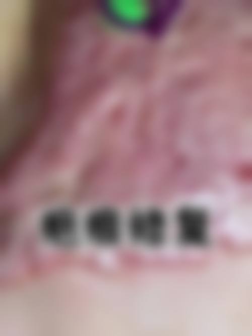 长春中 心医院综合烧伤科来院路线