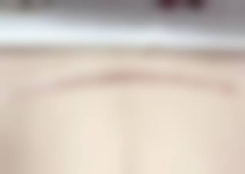 长春中 心医院综合烧伤科求美者反馈