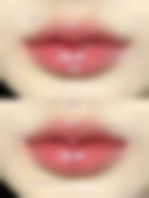 南昌秀妍白公主整形医院预约引导