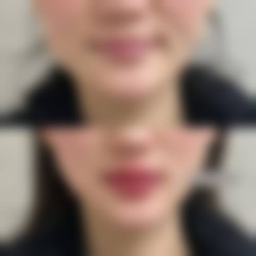 南昌秀妍白公主整形医院特色项目及技术优势