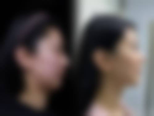 郑州大同医疗美容诊所求美者反馈