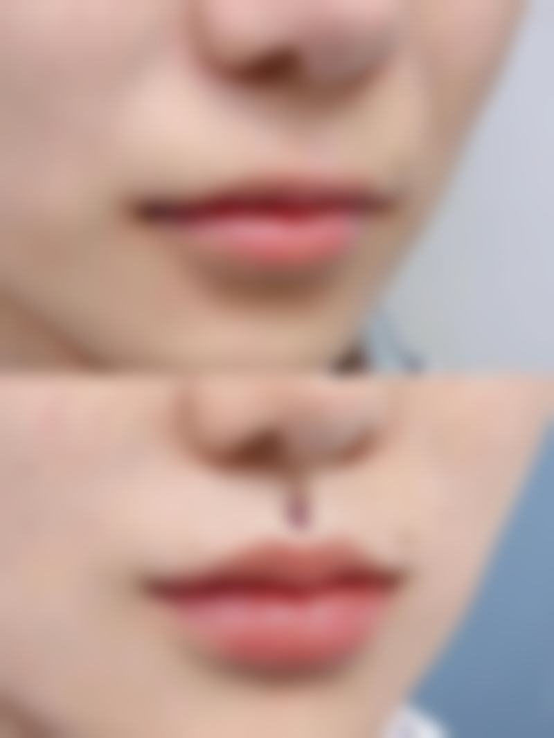 海南比华利特莱美医疗美容医院来院路线