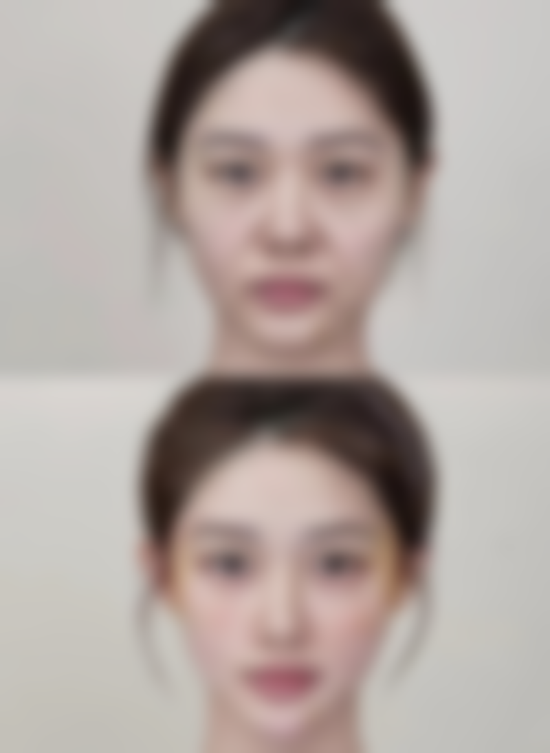 韩国VIP整形外科求美者反馈