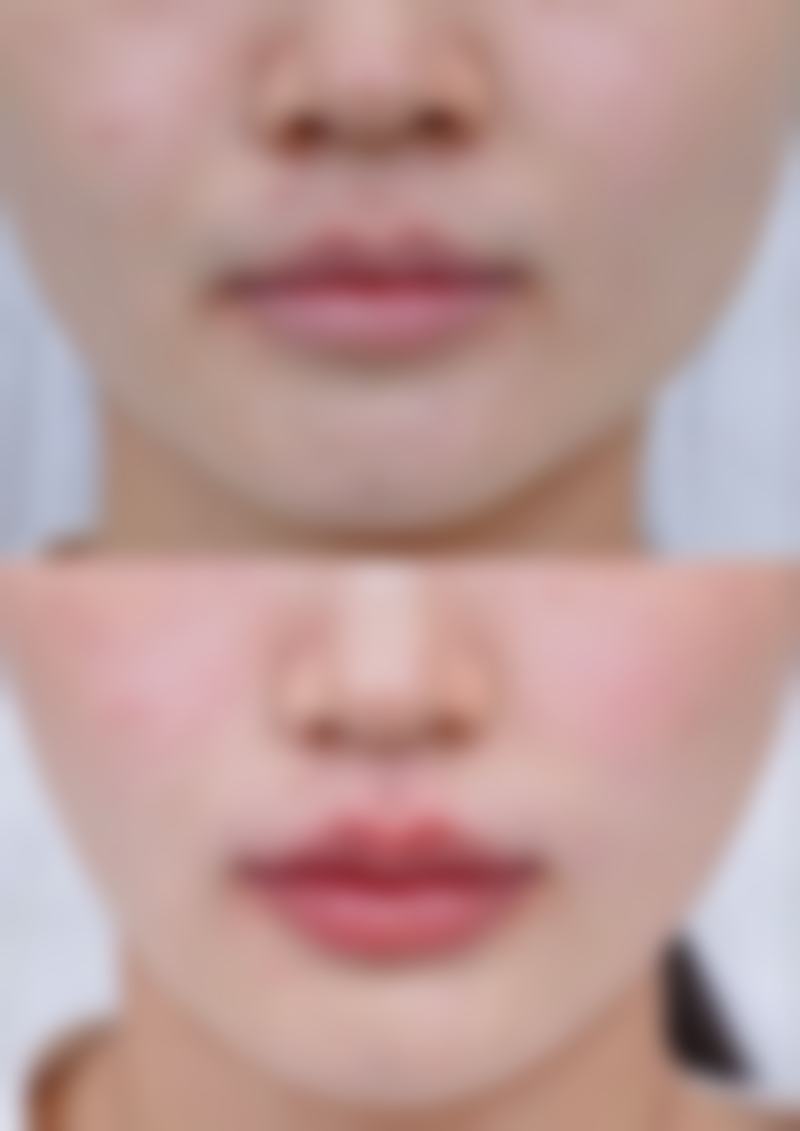 海南比华利特莱美医疗美容医院简介概述