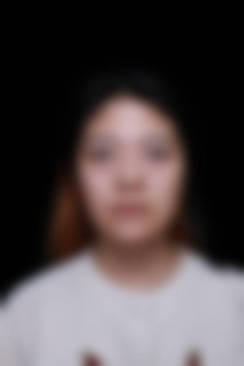 惠州蕊妍整形医院特色项目及技术优势