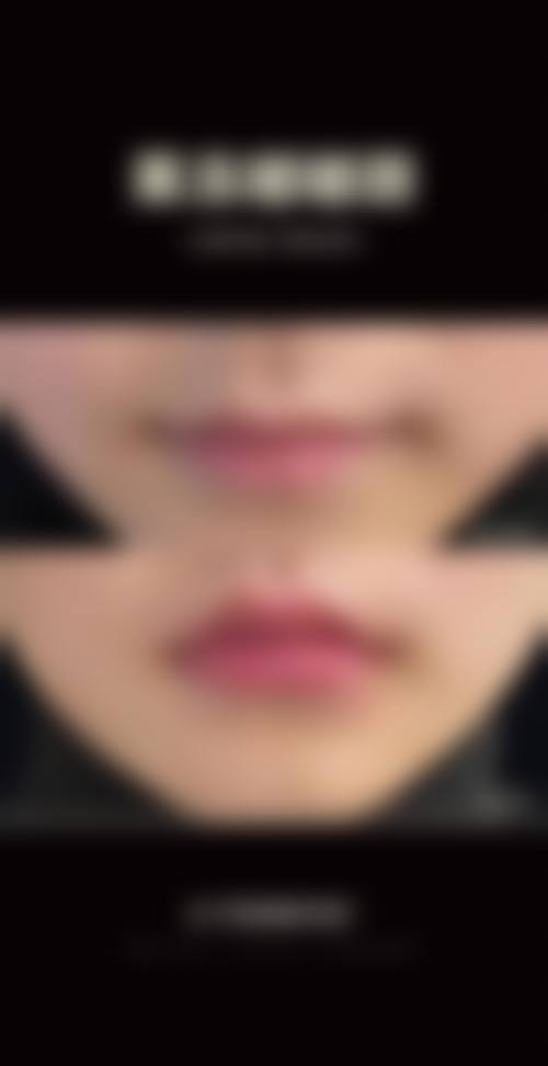 连云港美至尚整形医院求美者反馈