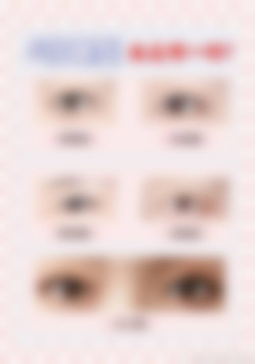 兰州西湖整形美容诊所价格收费