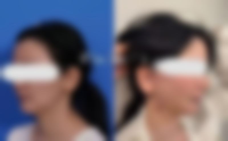 青岛美丽海内外整形医院特色项目及技术优势