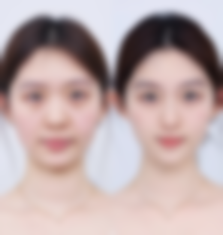 兰州西湖整形美容诊所求美者反馈